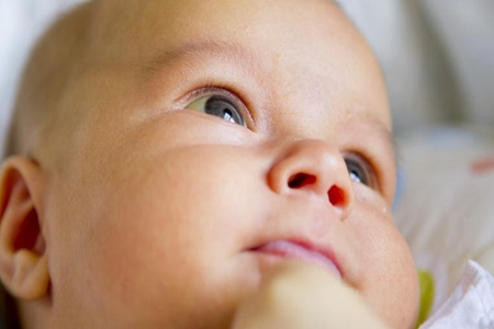 新生儿黄疸怎么办 学会这些方法快速退黄