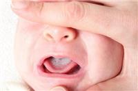 婴儿舌苔厚白是怎么回事？这五个原因宝妈及时